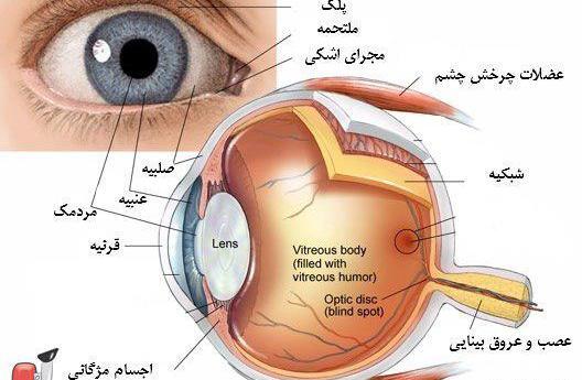 عکس سرطان چشم در کودکان