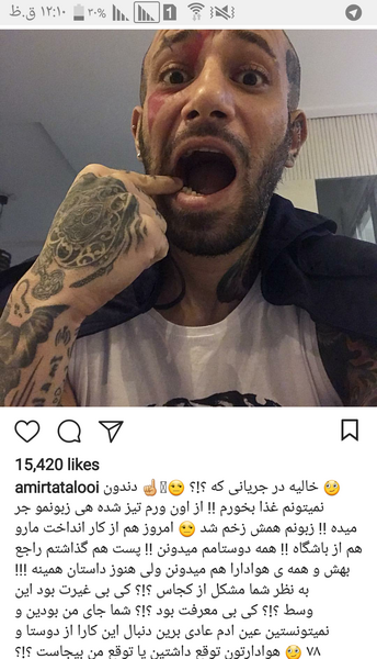 عکس زبون امیر تتلو