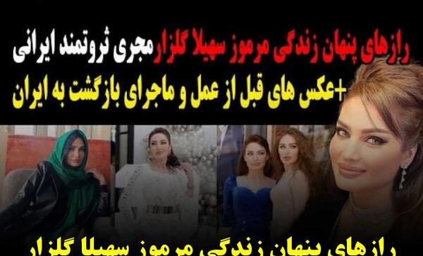 عکس سهیلا گلزار قبل از عمل