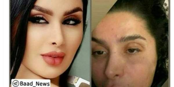 عکس سهیلا گلزار قبل از عمل