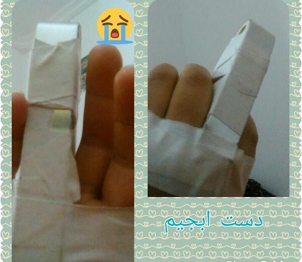 عکس فیک دخترونه دست شکسته