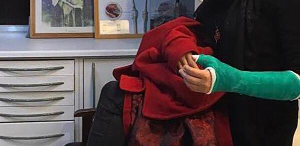 عکس فیک دخترونه دست شکسته