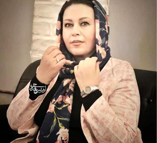 عکس گیتی قاسمی قبل از عمل