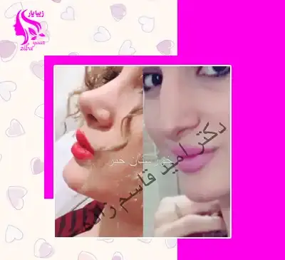 عکس دکتر قاسم زاده