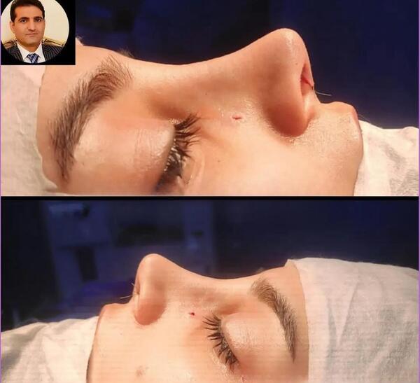 عکس دکتر قاسم زاده