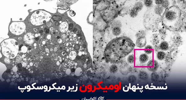 عکس کرونا با میکروسکوپ