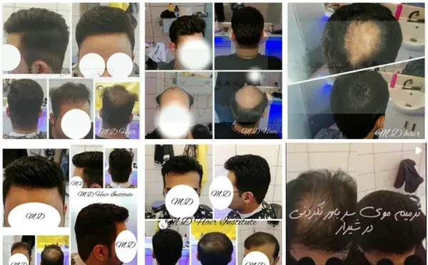عکس کلاه گیس پسرانه