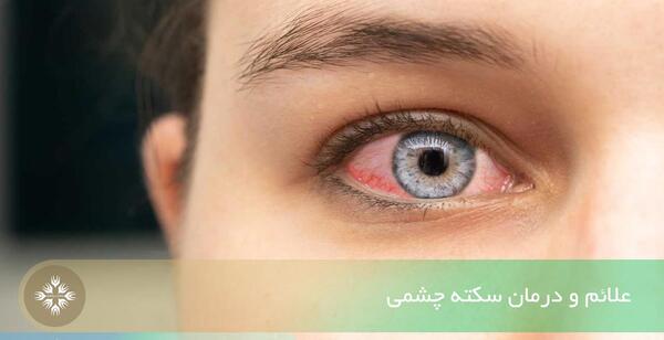 عکس نوشته درباره چشم هم چشمی