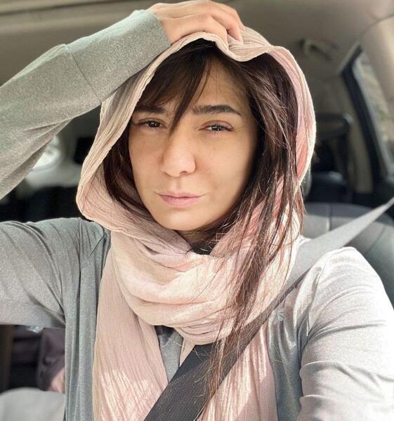 عکس قبل عمل مینا وحید