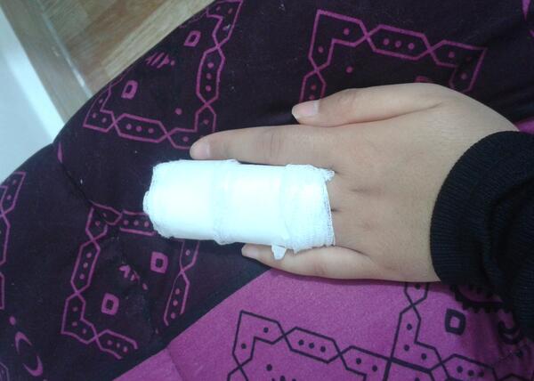 عکس فیک دست زخم شده دختر
