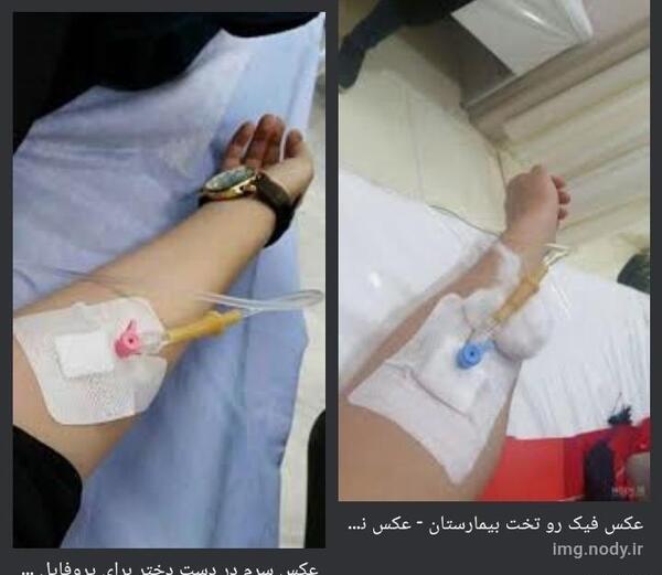 عکس فیک سروم دست دختر