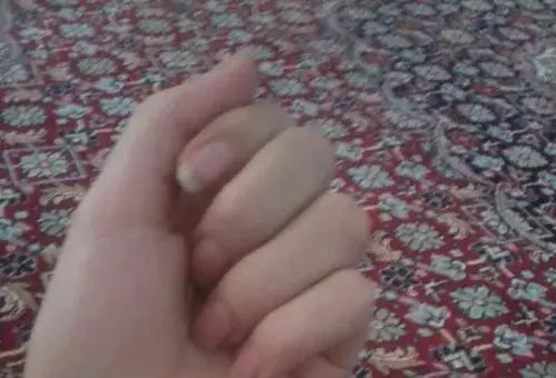 عکس فیک زخم کف دست