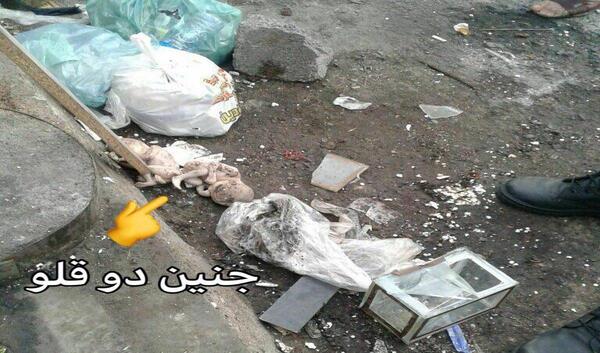 عکس جنین دو ماهه سقط شده