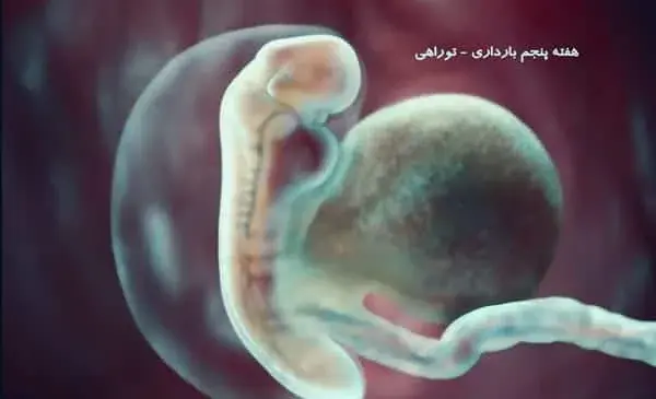 عکس سقط جنین در ماه اول