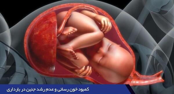 عکس سقط جنین ۴ماهه
