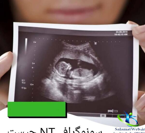 عکس جنین پسر در ان تی