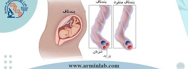 عکس جنین تک شریانی