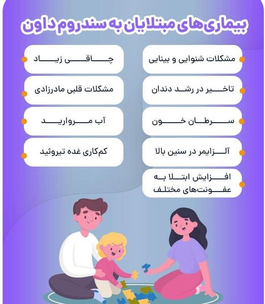 سقط عکس جنین مبتلا به سندروم داون