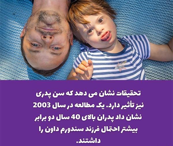 سقط عکس جنین مبتلا به سندروم داون