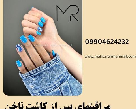 عکس نوشته مراقبت از ناخن کاشت