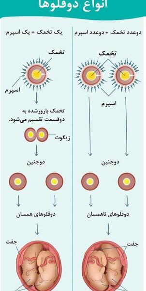 عکس نوشته بارداری دوقلویی