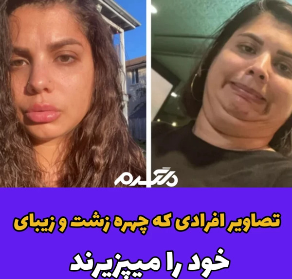 عکس نوشته من زشتم