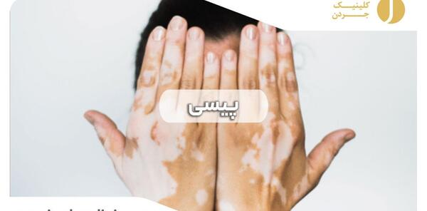 عکس برفک دهانه واژن