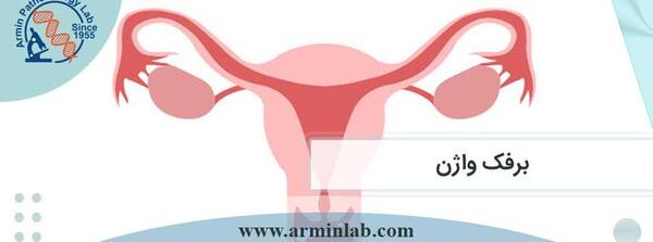 عکس برفک دهانه واژن