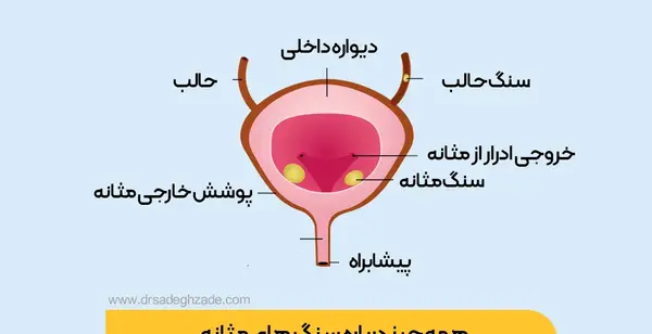 عکس مثانه
