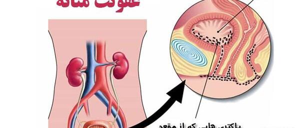 عکس مثانه