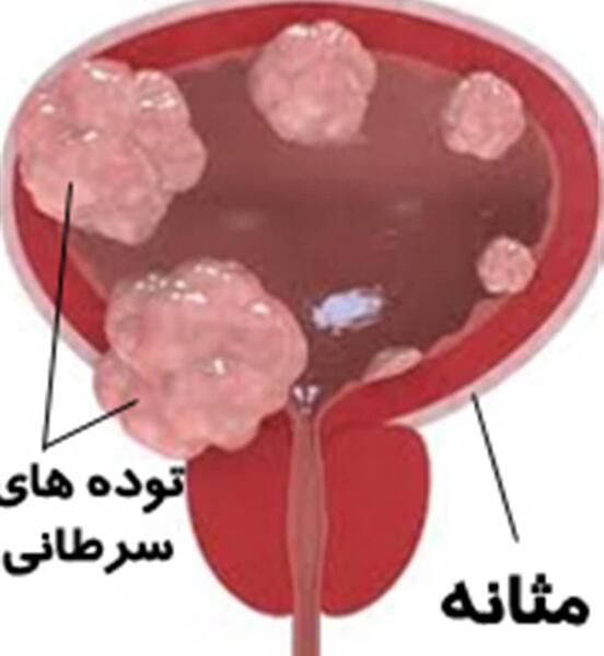 عکس مثانه