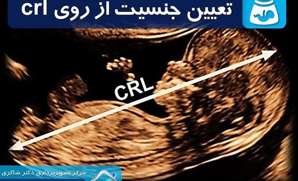 عکس ناف جنین دختر