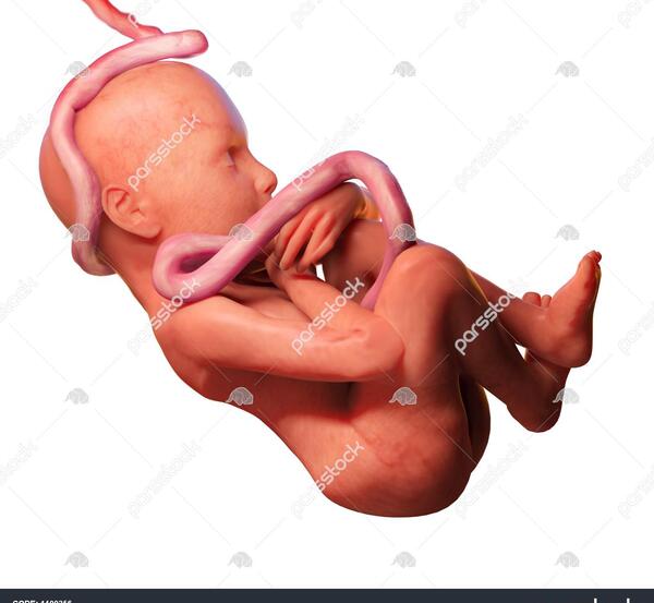 عکس بند ناف جنین