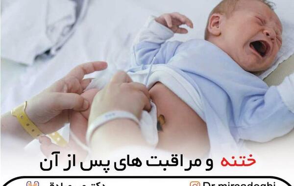 عکس ختنه مادرزادی
