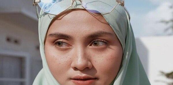 عکس خال مادرزادی