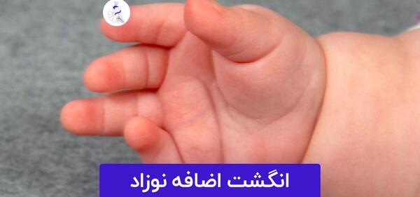 عکس دست مادرزادی