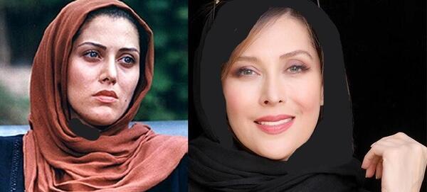 عکس زنان قبل و بعد از عمل زیبایی