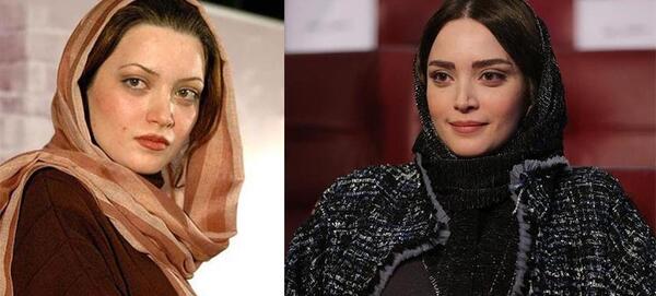 عکس زنان قبل و بعد از عمل زیبایی