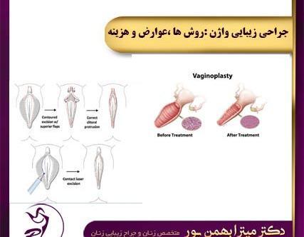 عکس جراحی زیبایی زنان