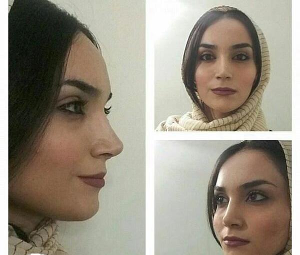 عکس جراحی زیبایی زنان