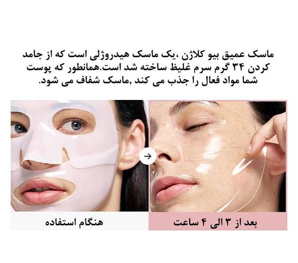 عکس اکس بند بدون ماسک صورت