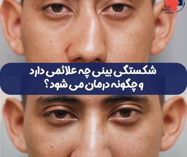عکس صورت اکس بند بدون نقاب
