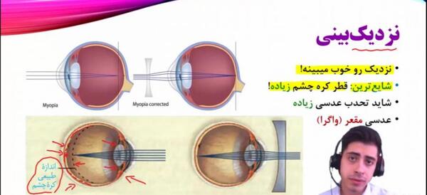 عکس عدسی چشم گاو