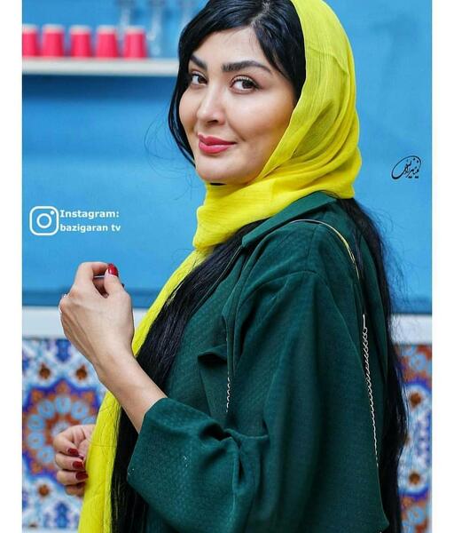 عکس مریم معصومی بعد از عمل بینی