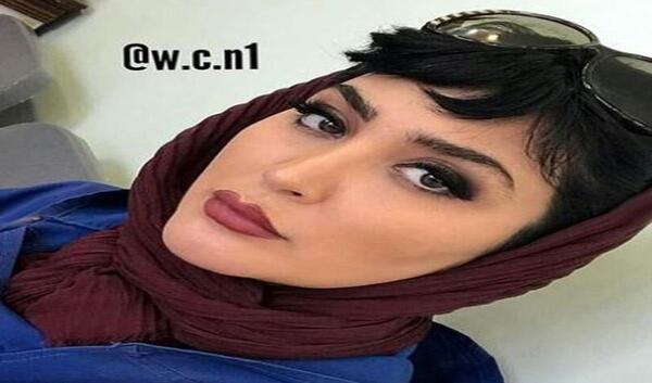 عکس مریم معصومی بعد از عمل بینی