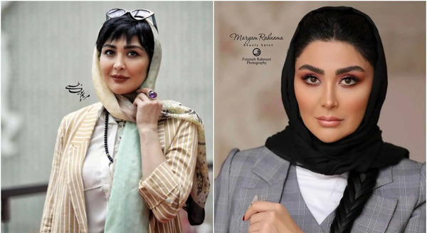 عکس مریم معصومی بعد از عمل بینی