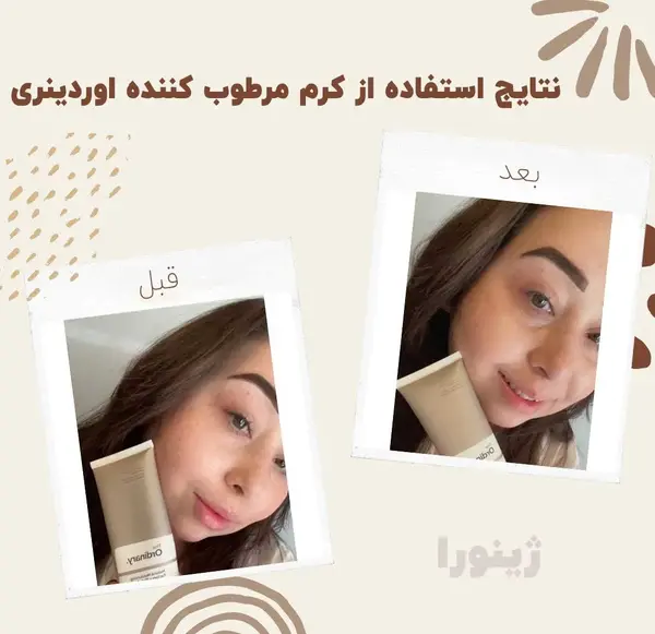 عکس استفاده از مرطوب کننده