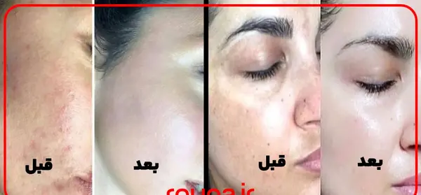 عکس استفاده از مرطوب کننده