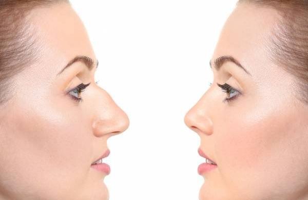 عکس آتلیه برای عمل بینی