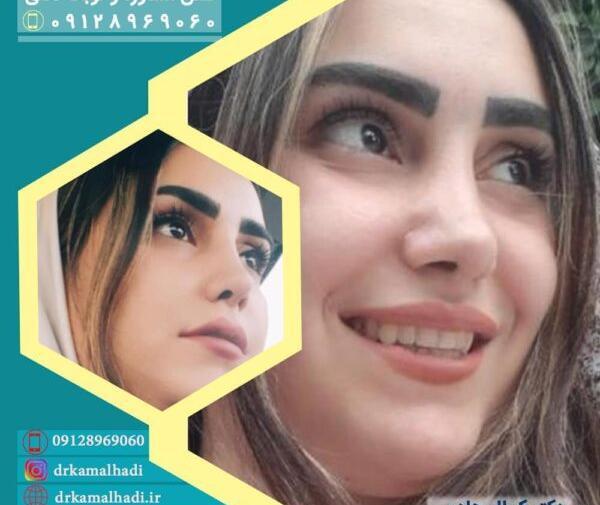 عکس آتلیه برای عمل بینی